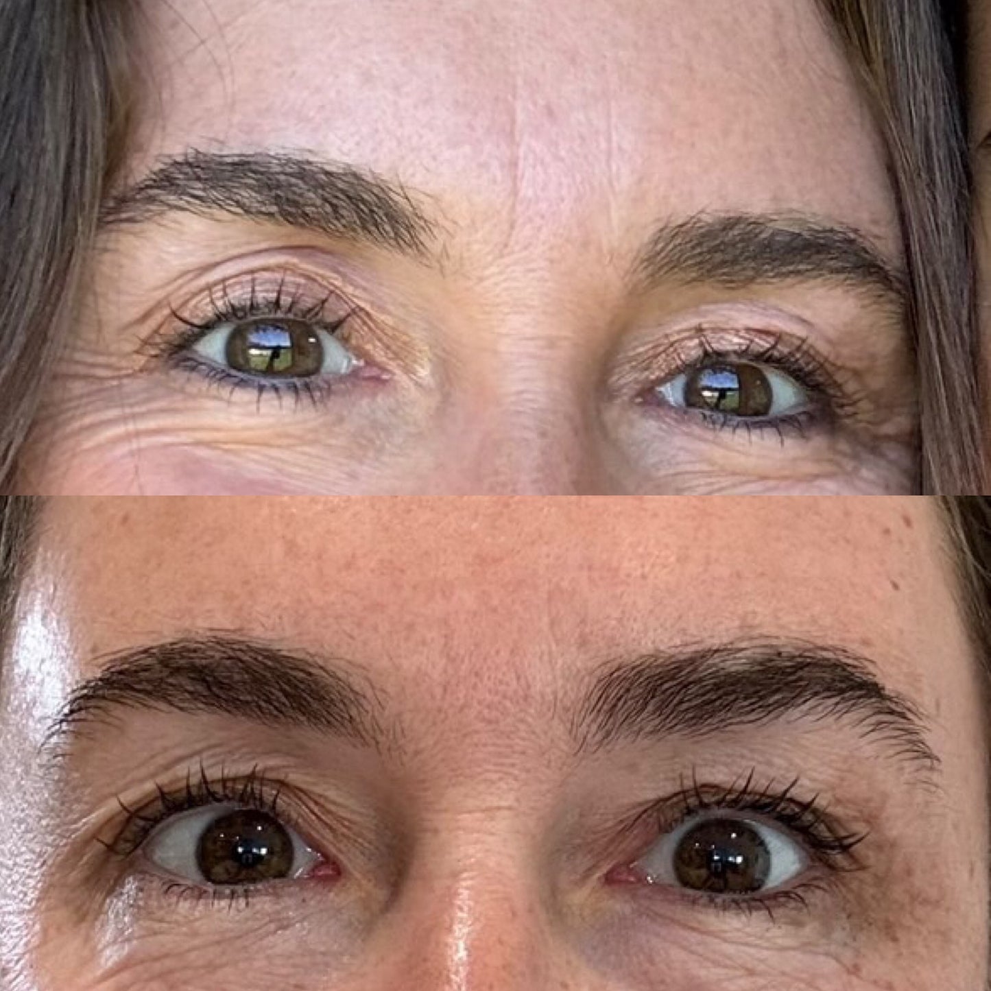 Bio Collagen Mask