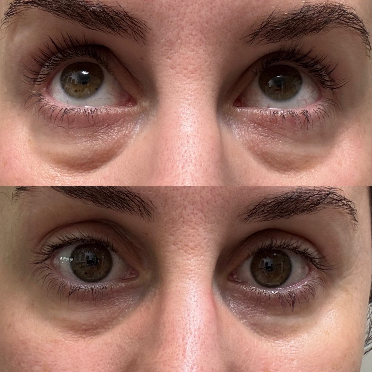 C Eye Revival Masks for Dark Circles, Puffiness & Tired Eyes