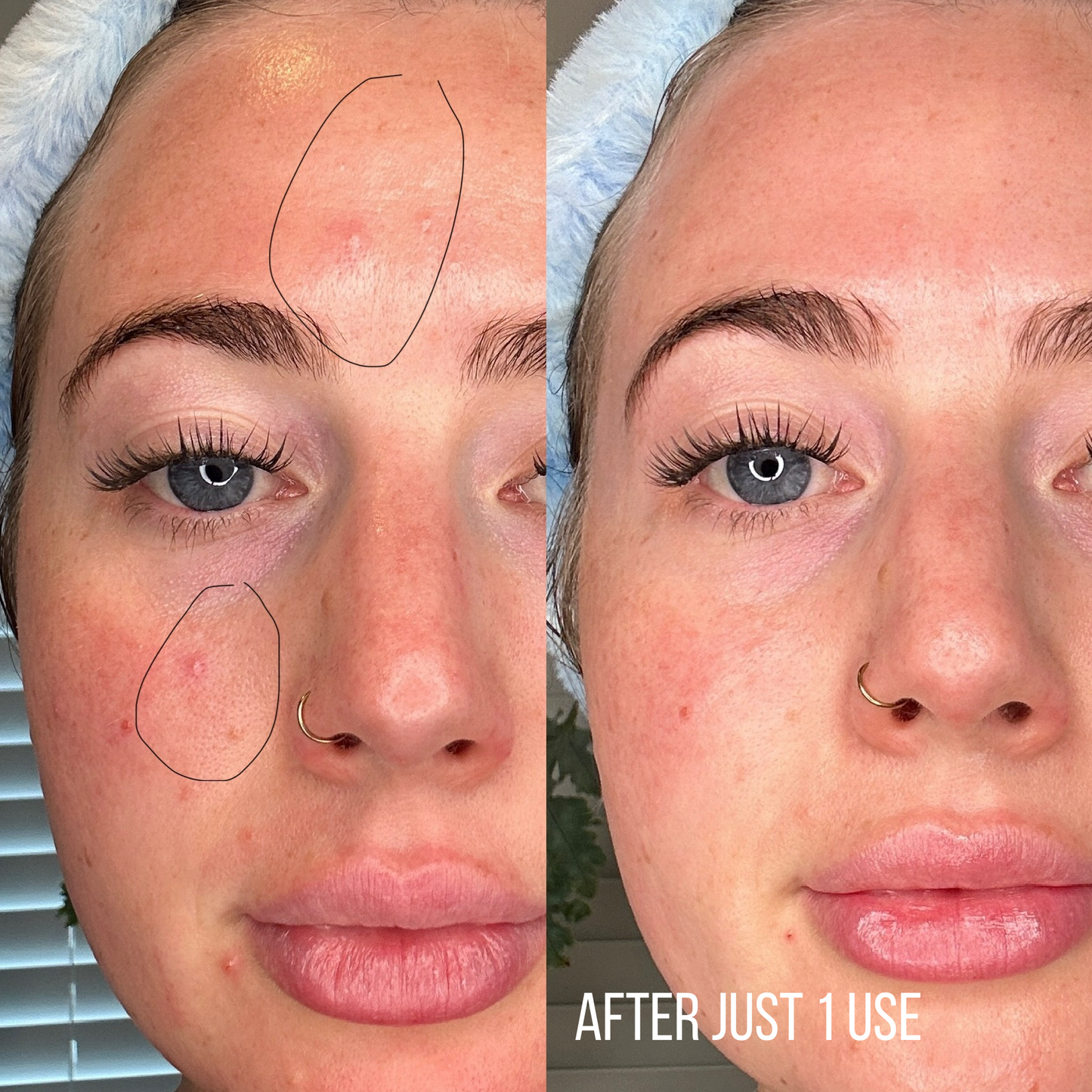 Bio Collagen Mask