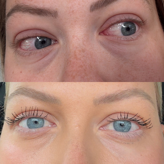 C Eye Revival Masks for Dark Circles, Puffiness & Tired Eyes