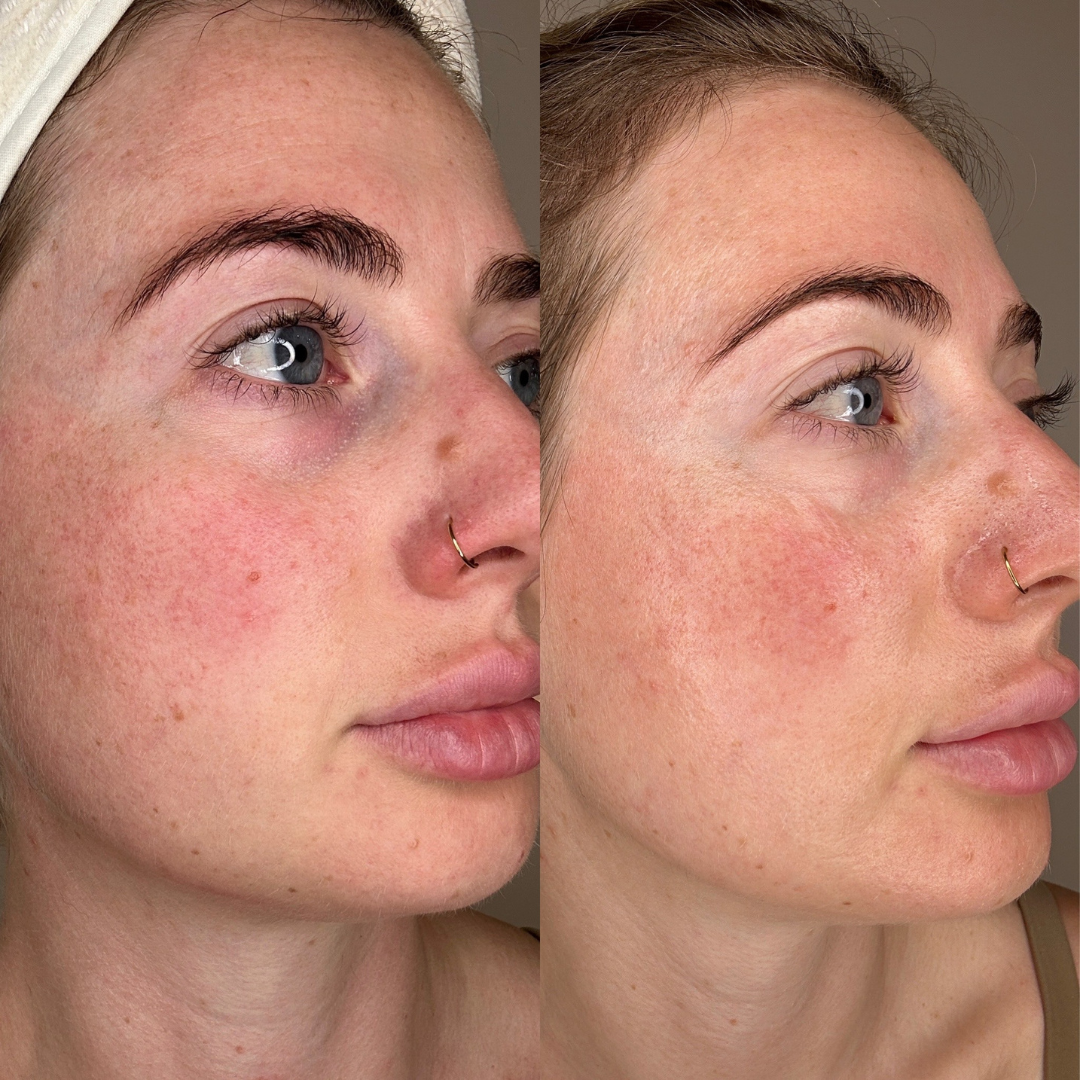 Bio Collagen Mask 10pk