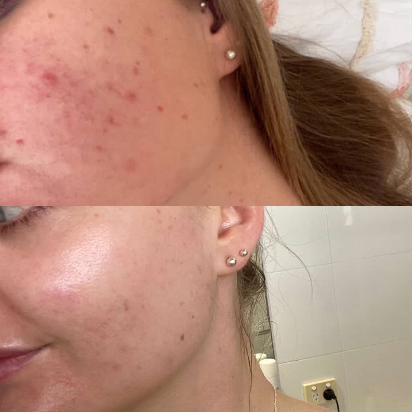 Bio Collagen Mask