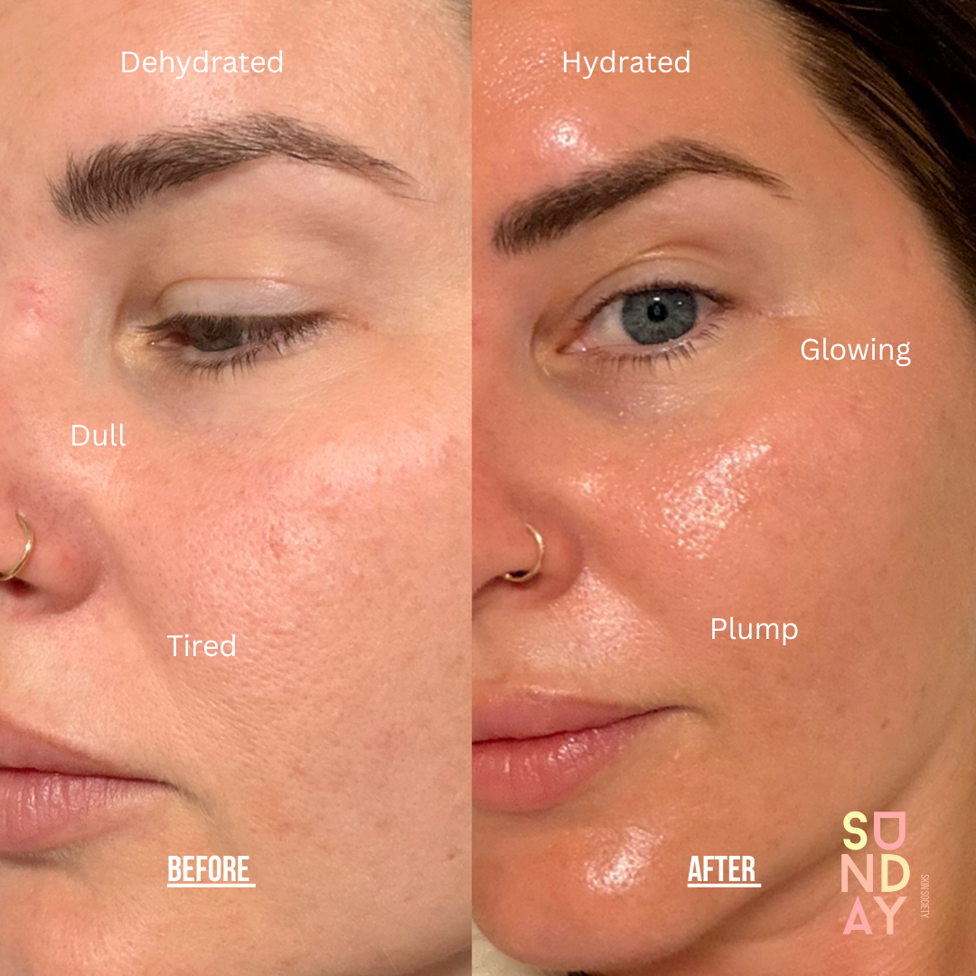 Bio Collagen Mask