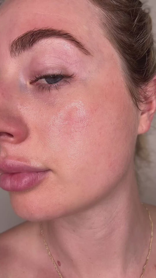 Full Radiance Set (8 packs)